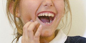 歯茎の露出部分が大きい